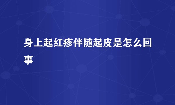 身上起红疹伴随起皮是怎么回事